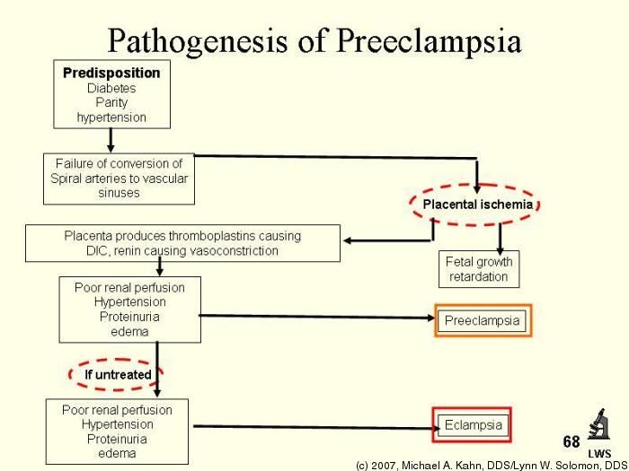 প্রিএক্লামশিয়া নিয়ে যত কথা 2 প্রিএক্লামশিয়া নিয়ে যত কথা 2