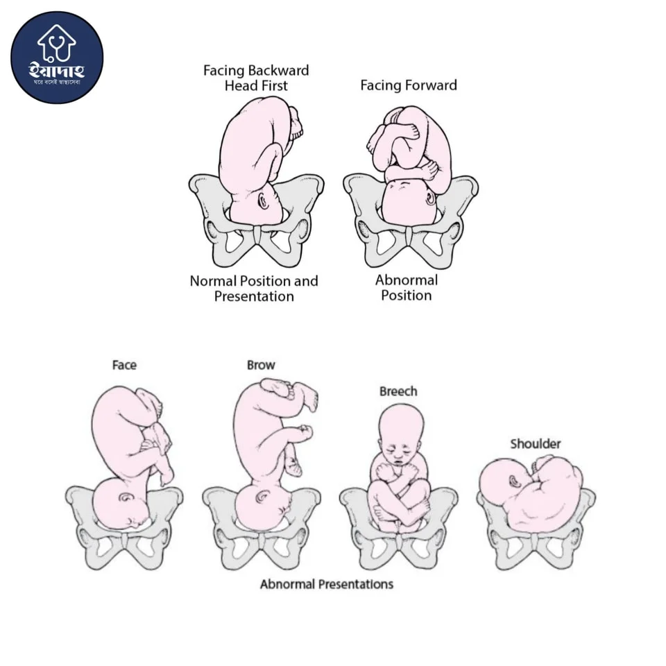 বাচ্চার বিভিন্ন পজিশন